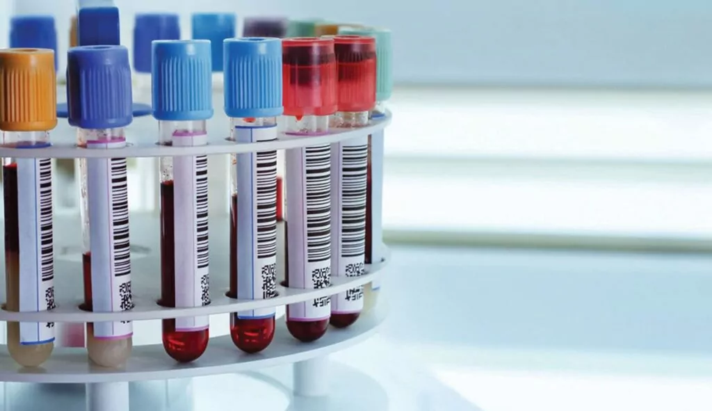 Hematologista