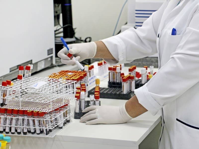 Sto André Ribeirão Pires e Mauá Iniciam Exames Covid-19 Medicina ABC