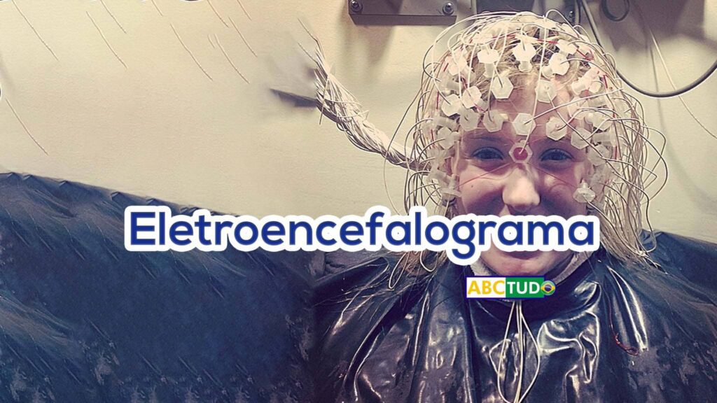Eletroencefalograma - Preparo para o Exame