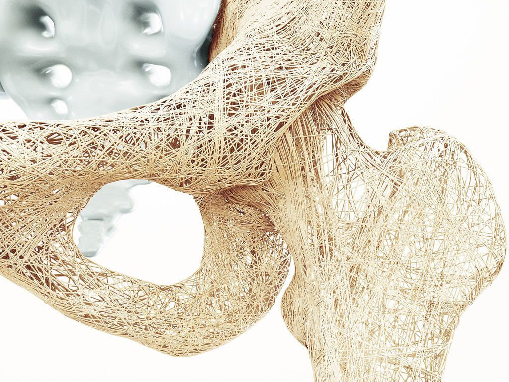 Osteoporose Sbem Sp
